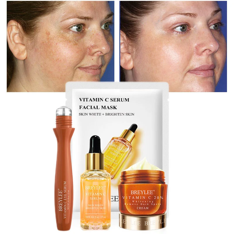 BREYLEE Vitamin C Whitening Set Face Cream Facial Serum Mask Eye Cream Remove Spots Freckles Dark Circles Moisturizing Skin Care
BREYLEE Vitamin C Whitening Set Face Cream Facial Serum Mask Eye Cream Remove Spots Freckles Dark Circles Moisturizing Skin Care