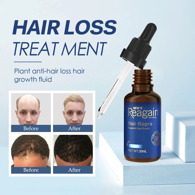Hair Repro Nourish Hair Roots Anit Hair Loss Product for Men/Women Hair and Beard Care Oil Treatments to Regain Thick Hair
Hair Repro Nourish Hair Roots Anit Hair Loss Product for Men/Women Hair and Beard Care Oil Treatments to Regain Thick Hair