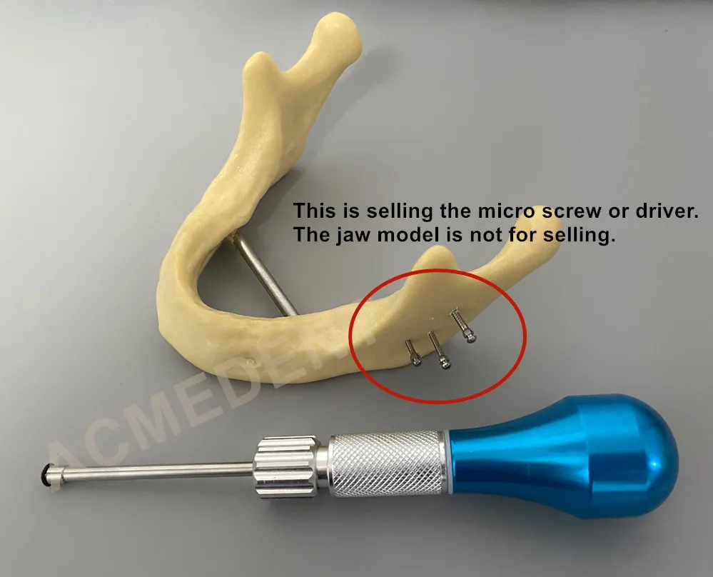 

2Pcs Orthodontic Screws Micro Implants Mini Screw Dental Self-Drilling Driver Spring Anchor Implant Driver Screwdriver