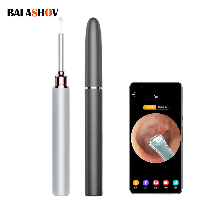 Intelligent Visual Ear Stick Ear Picker 500W Wireless High Precision Endoscope Mini Camera Otoscope Borescope USB Ear Cleaner
Intelligent Visual Ear Stick Ear Picker 500W Wireless High Precision Endoscope Mini Camera Otoscope Borescope USB Ear Cleaner