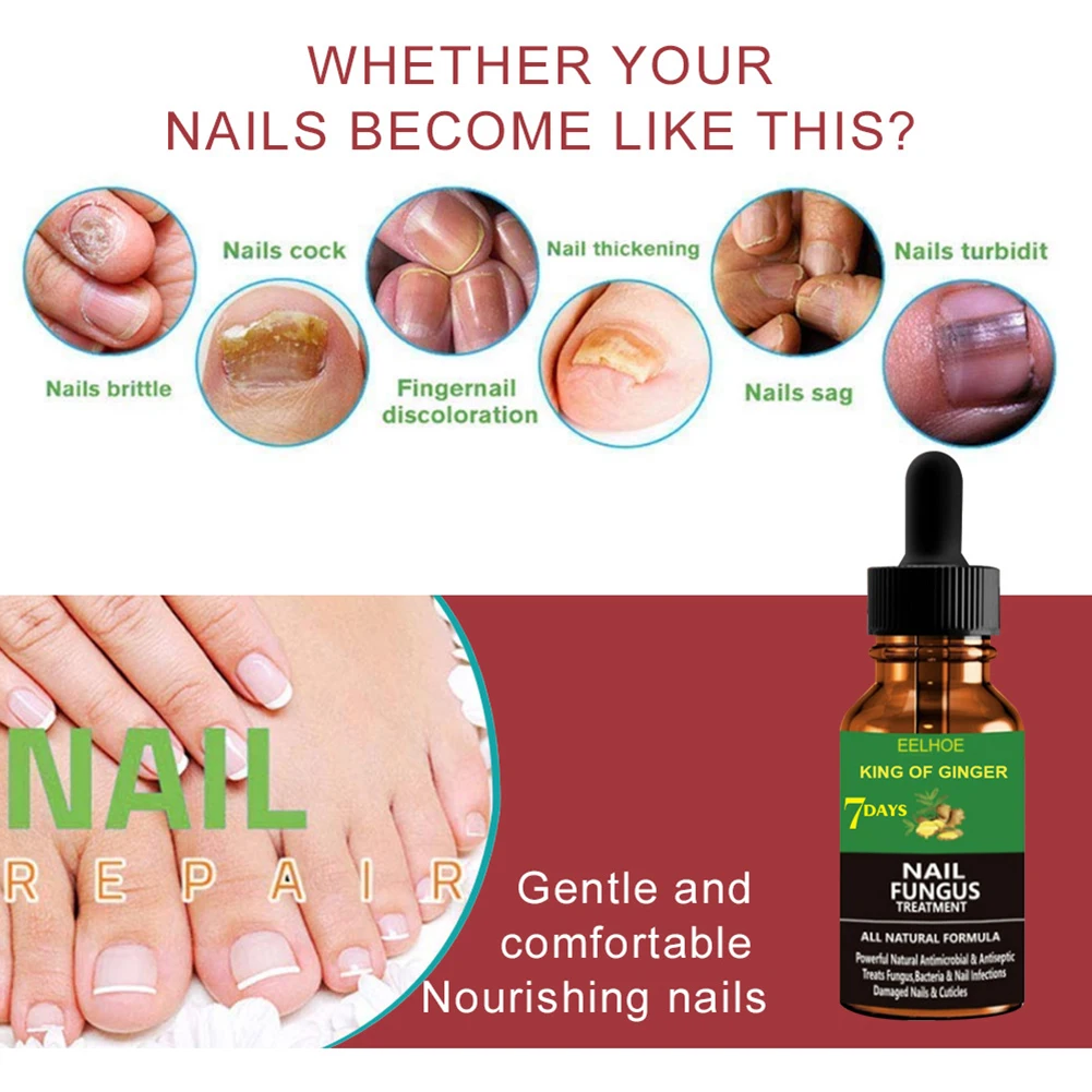Nail Care Repair Liquid Foot Anti-fungal To Remove Onychomycosis Repair Treatment Liquid Healthy Improves The Appearance TSLM 1
Nail Care Repair Liquid Foot Anti-fungal To Remove Onychomycosis Repair Treatment Liquid Healthy Improves The Appearance TSLM 1