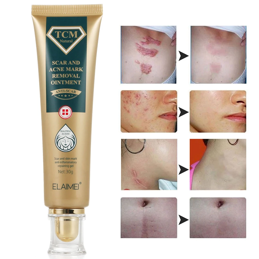 Scar Repair Cream Remove Burn Scars Antibacterial Anti-inflammatory Lighten Stretch Marks Acne Treatment Smoothing Skin Care
Scar Repair Cream Remove Burn Scars Antibacterial Anti-inflammatory Lighten Stretch Marks Acne Treatment Smoothing Skin Care