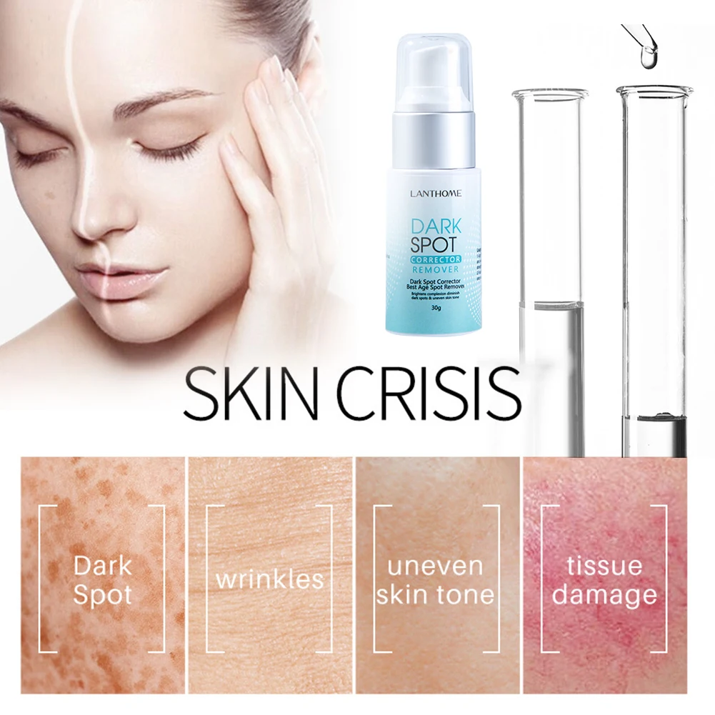 30g Dark Spot Remover Corrector Age Spot Freckle Removal Emulsion Whitening Moisturizing Anti-aging Skin Repair Skin Care
30g Dark Spot Remover Corrector Age Spot Freckle Removal Emulsion Whitening Moisturizing Anti-aging Skin Repair Skin Care
