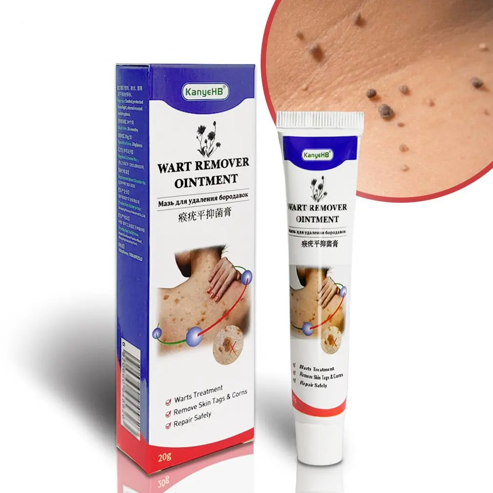 1pcs Wart Ointment Wart Treatment Cream Neck Skin Genital Wart Armpit Wart Feet Calluses Medical Wart Cream
1pcs Wart Ointment Wart Treatment Cream Neck Skin Genital Wart Armpit Wart Feet Calluses Medical Wart Cream