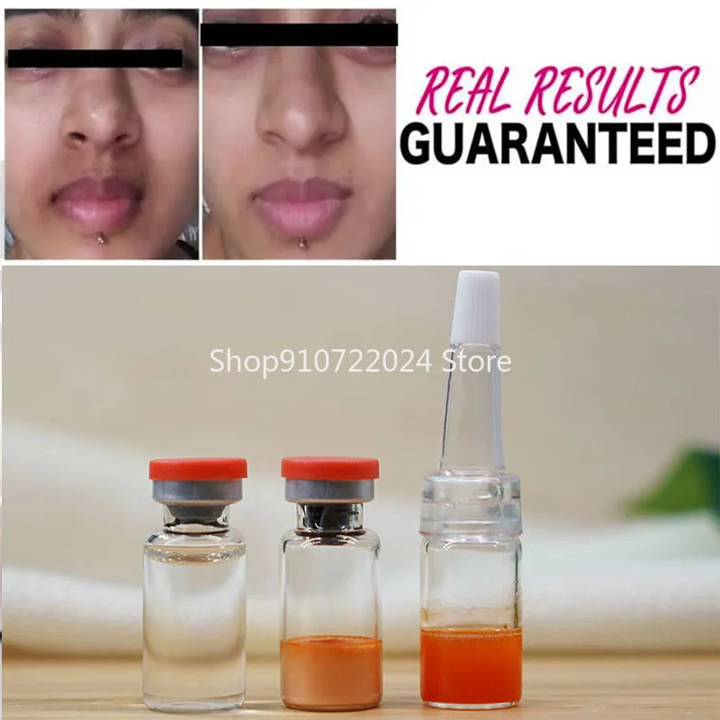 3ml 1 pair Remove Darkness Around Mouth and Chin Whitening Dark Spot Freckles More 100% Effective Free shipping
3ml 1 pair Remove Darkness Around Mouth and Chin Whitening Dark Spot Freckles More 100% Effective Free shipping
