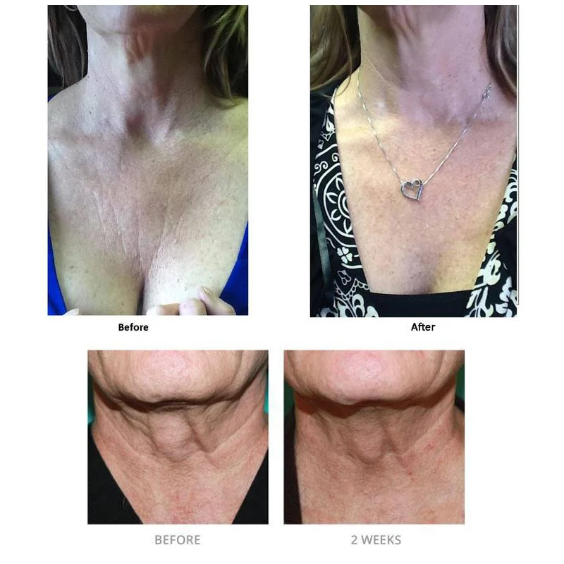 40ml Xhekpon Cream Face and Neck Wrinkle Removing Cream Neck Line Erasing Wrinkle Smooth Skin Anti aging Whitening Cream
40ml Xhekpon Cream Face and Neck Wrinkle Removing Cream Neck Line Erasing Wrinkle Smooth Skin Anti aging Whitening Cream