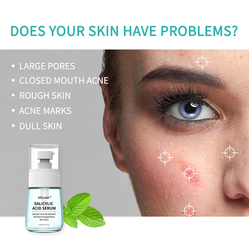 "MSLAM Salicylic Acid Solution Essence Acne Spot Removing Pores Unclog Clear Face Skin Care "
"MSLAM Salicylic Acid Solution Essence Acne Spot Removing Pores Unclog Clear Face Skin Care "