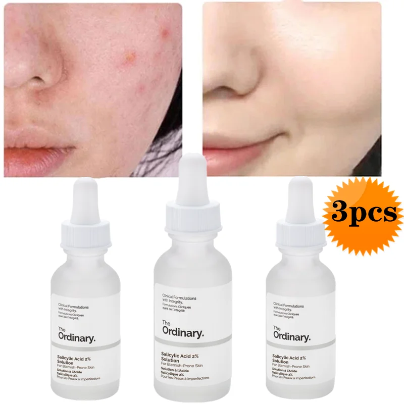 30ml Salicylic Acid 2% Solution Removes Acne Shrinks Pore Fade Spot Brighten Face Serum Moisturizing Essence Face Skin Care 1PCS
30ml Salicylic Acid 2% Solution Removes Acne Shrinks Pore Fade Spot Brighten Face Serum Moisturizing Essence Face Skin Care 1PCS