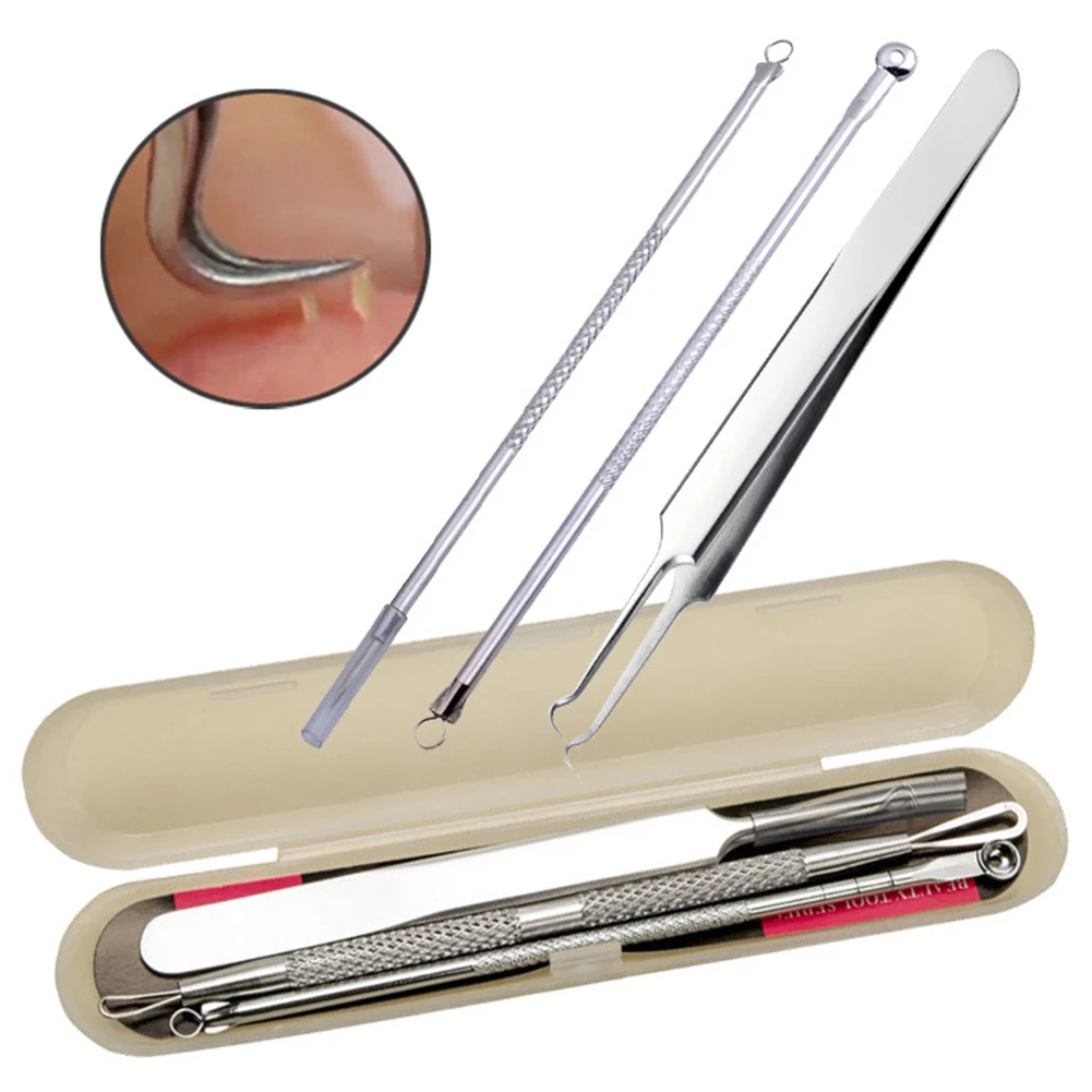 Anti-allergy treatment 3-piece stainless steel double-head acne needle acne needle
Anti-allergy treatment 3-piece stainless steel double-head acne needle acne needle