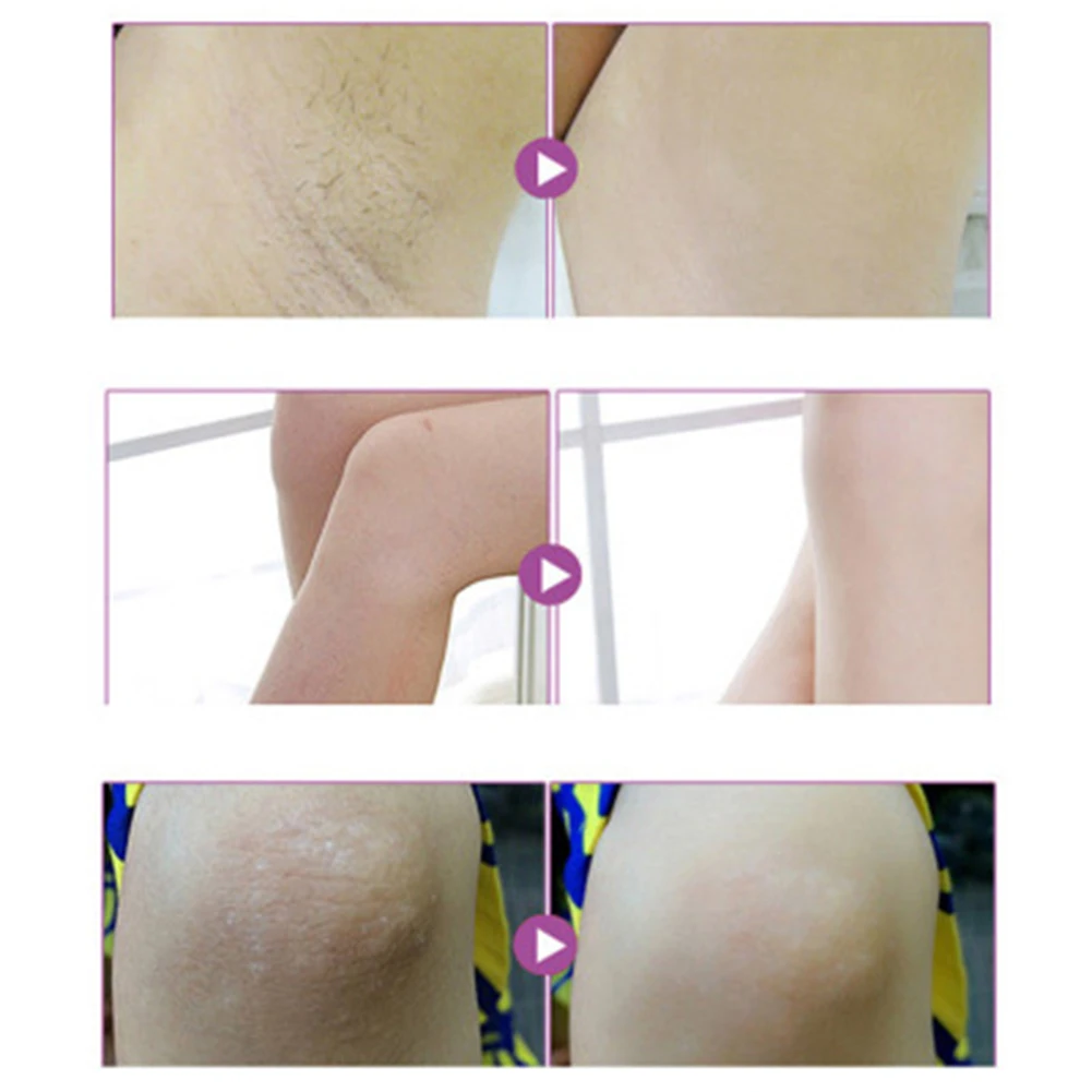 Beauty Body Creams Armpit Whitening Cream Between Legs Knees Private Parts Whitening Formula Armpit Whitener Intimate
Beauty Body Creams Armpit Whitening Cream Between Legs Knees Private Parts Whitening Formula Armpit Whitener Intimate