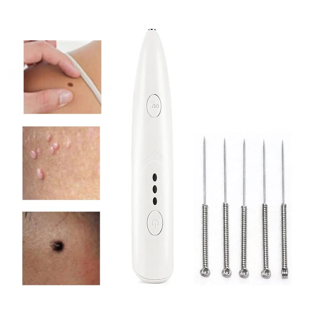 Plasma Freckle Remove Pen Wart Remover Machine Mole Tattoo Remover Skin Tag Removal Spot Cleaner Beauty Care tool
Plasma Freckle Remove Pen Wart Remover Machine Mole Tattoo Remover Skin Tag Removal Spot Cleaner Beauty Care tool