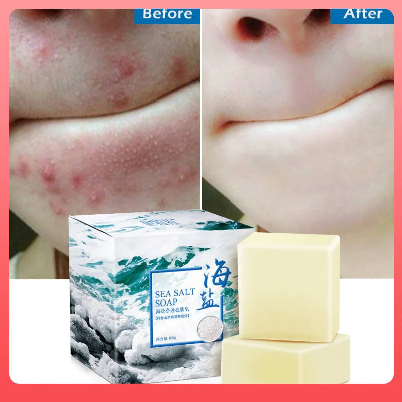 100g Sea Salt Soap Removal Pimple Pore Acne Treatment Sea Salt Soap Moisturizing Goat Milk Soap Base Skin Care Soap TSLM1
100g Sea Salt Soap Removal Pimple Pore Acne Treatment Sea Salt Soap Moisturizing Goat Milk Soap Base Skin Care Soap TSLM1