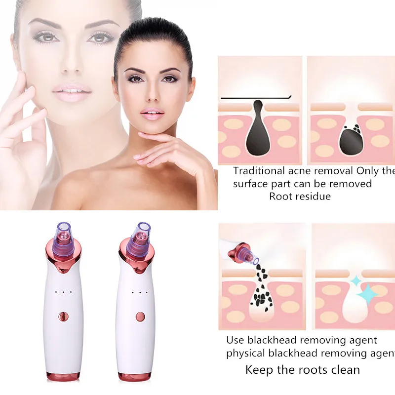 Blackhead Remover Black Dot Face Pore Vacuum Black Head Remover Blackhead Extractor Removal Vacuum Suction Cleaner Facial Tool
Blackhead Remover Black Dot Face Pore Vacuum Black Head Remover Blackhead Extractor Removal Vacuum Suction Cleaner Facial Tool