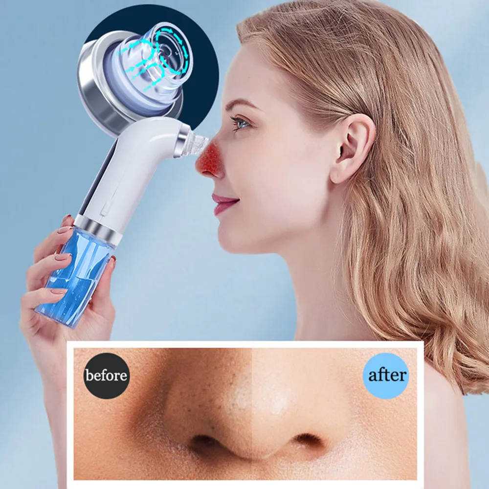 Hot Water Cycle Electric Facial Vacuum Pore Blackhead Cleaner Acne Pimple Cleaning Remover Tool Blemish Removers Beauty Devices
Hot Water Cycle Electric Facial Vacuum Pore Blackhead Cleaner Acne Pimple Cleaning Remover Tool Blemish Removers Beauty Devices