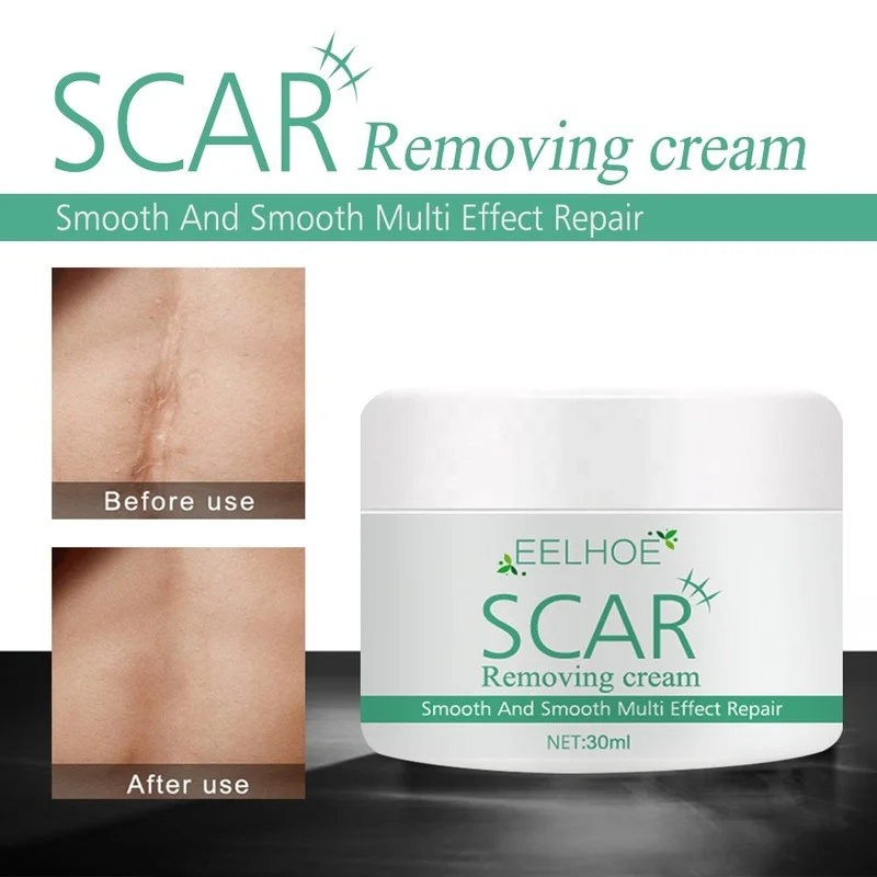 Repair Scar Ointment Skin External Trauma Ointment Wound Small Wound Care Scar Skin Care Lotion 
Repair Scar Ointment Skin External Trauma Ointment Wound Small Wound Care Scar Skin Care Lotion