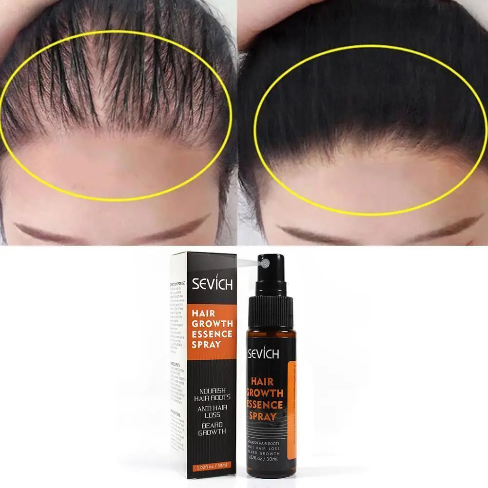 Sevich 30ml Plants Essence Hair Growth Spray For hair Repair Faster Growing Loss Hair Product preventing Hair Anti treatmen S4S8
Sevich 30ml Plants Essence Hair Growth Spray For hair Repair Faster Growing Loss Hair Product preventing Hair Anti treatmen S4S8
