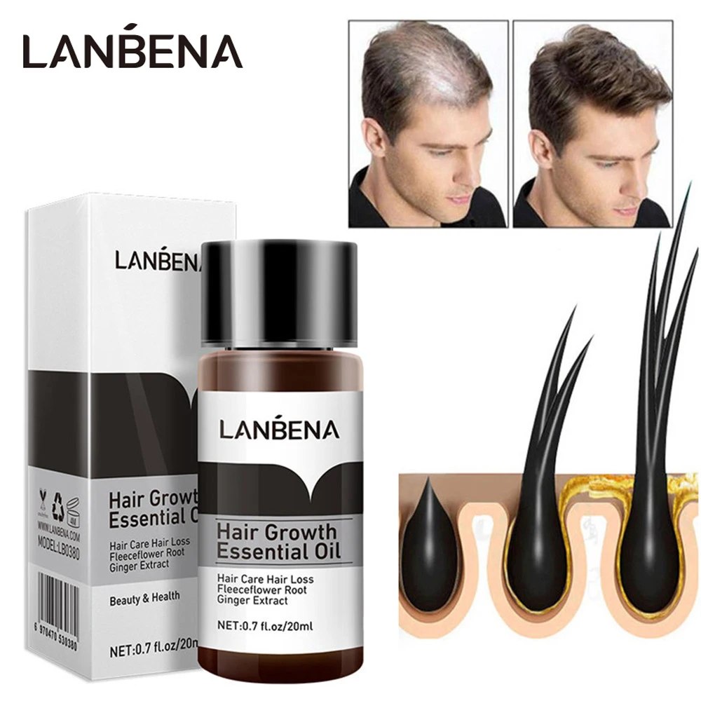 7 Days Hair Growth Essential Oil Ginger Anti Hair Loss Products Fast Germinal Serum Nourish Hair Roots Repair Hair Dry Damaged
7 Days Hair Growth Essential Oil Ginger Anti Hair Loss Products Fast Germinal Serum Nourish Hair Roots Repair Hair Dry Damaged