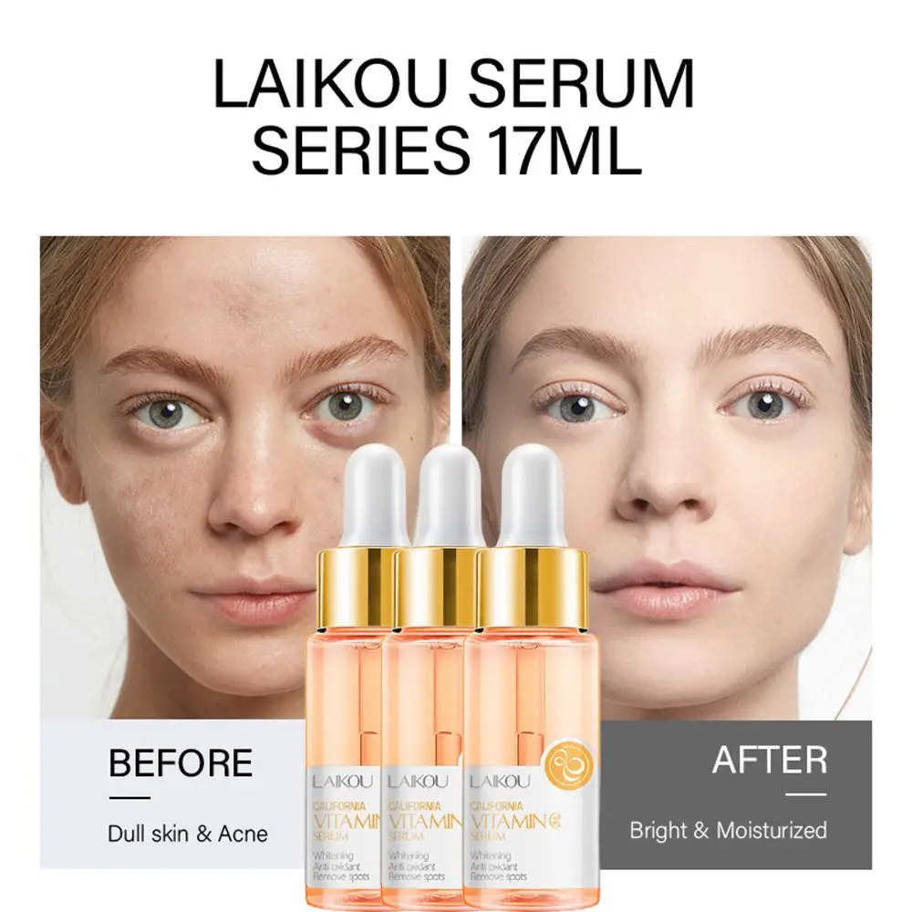 Tightening Skin Essence Blemish Remover Fade Spots Anti Wrinkle Vitamin C Face Serum Lightening Anti aging
Tightening Skin Essence Blemish Remover Fade Spots Anti Wrinkle Vitamin C Face Serum Lightening Anti aging
