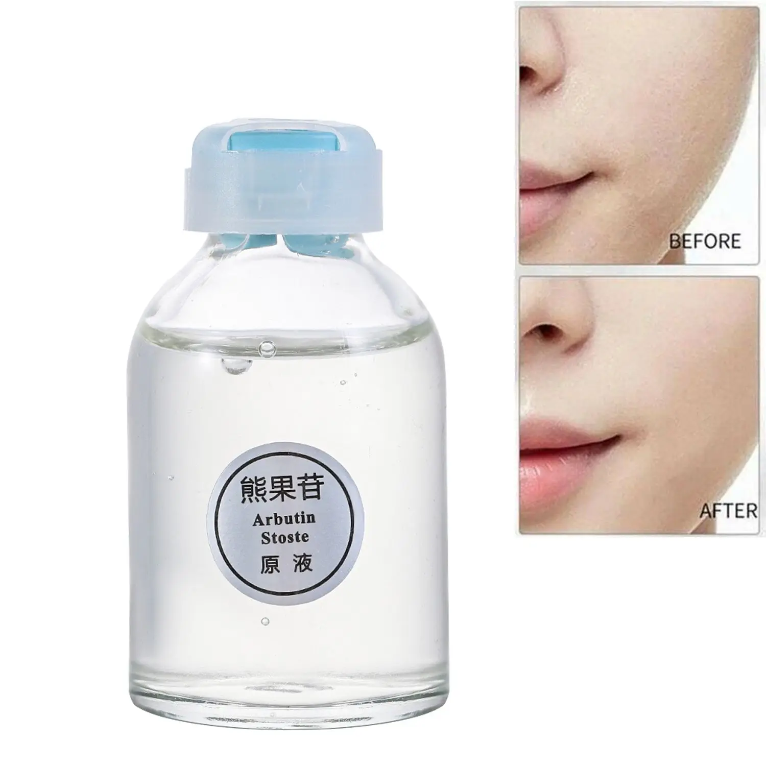 Hot Sale Facial Skin Care Liquid Effective Skin Brightening Essence Lightening Chloasma Whitening
Hot Sale Facial Skin Care Liquid Effective Skin Brightening Essence Lightening Chloasma Whitening