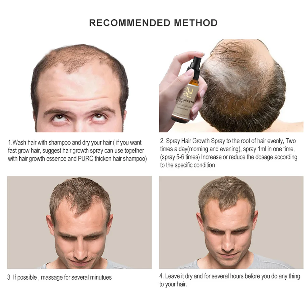 Профессиональная машинка для стрижки волос спрей роста зародышевый безопасный выдержки имбиря от головы парикмахерские лечение Портативн...
Профессиональная машинка для стрижки волос спрей роста зародышевый безопасный выдержки имбиря от головы парикмахерские лечение Портативн...