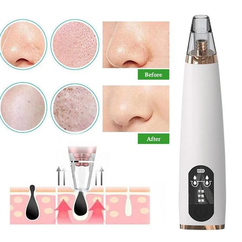 Face Nose Deep Cleaner Electric Vacuum Blackhead Remover Machine T Zone Pore Acne Pimple Removal Beauty Devices Tool
Face Nose Deep Cleaner Electric Vacuum Blackhead Remover Machine T Zone Pore Acne Pimple Removal Beauty Devices Tool