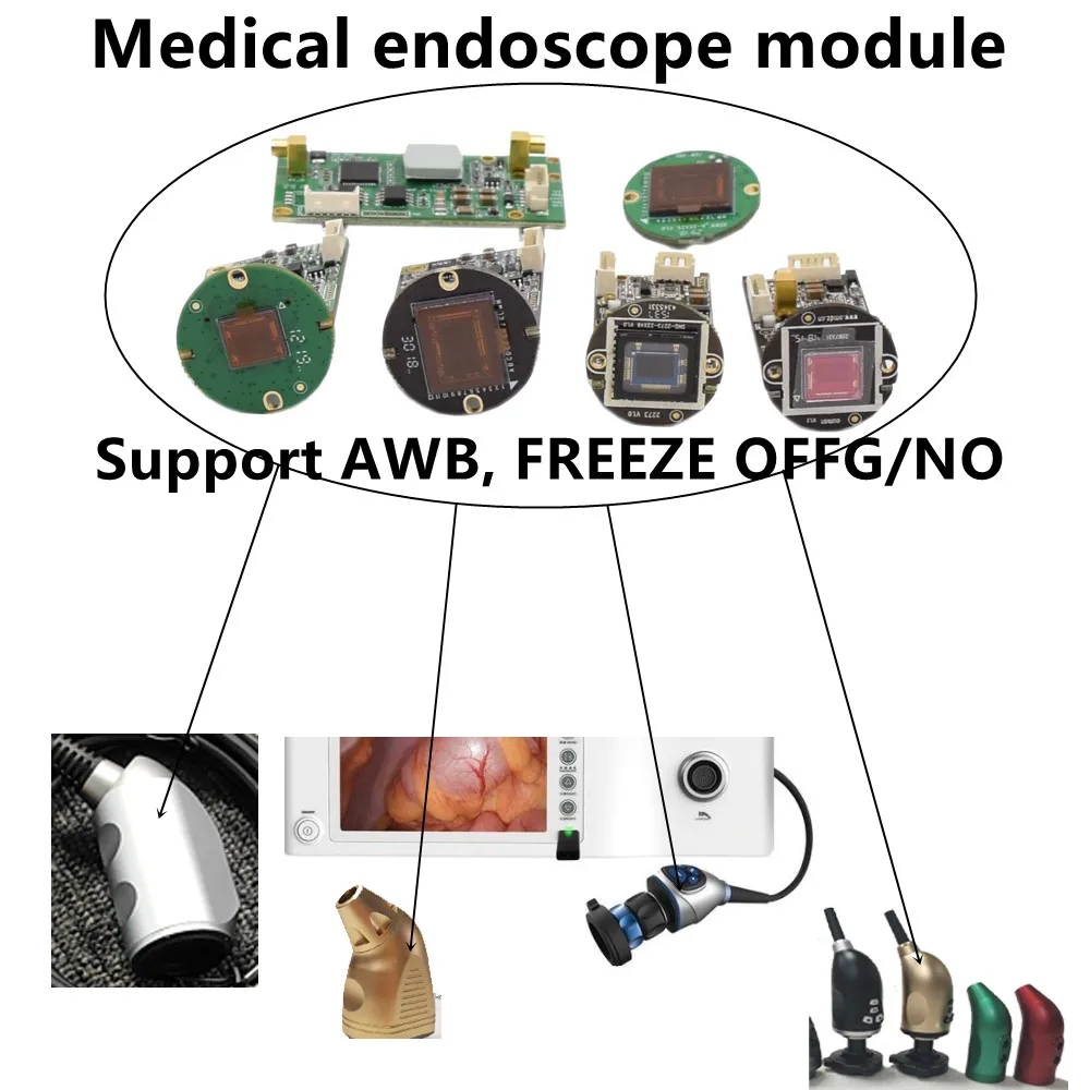 

SDI Medical Camera Module White Balance AWB Freeze Opens and Closes Electronic Magnification with One Click 60fps Hysteroscopy