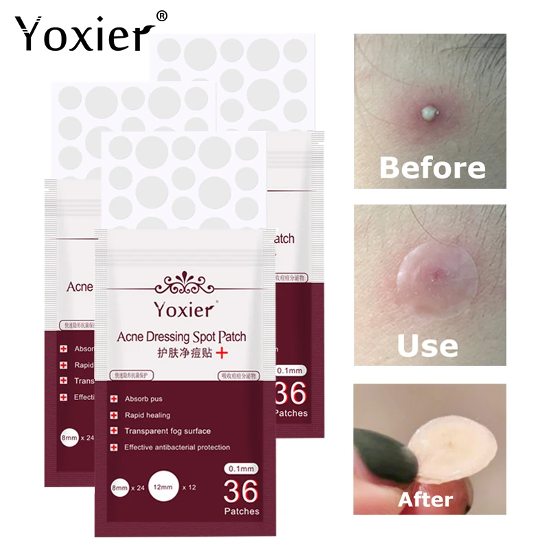 Acne Pimple Patch Facial Skin Care Tool Waterproof Removal Of Acne Oil Control And Spot Mask Skin Care 3pcs/lot
Acne Pimple Patch Facial Skin Care Tool Waterproof Removal Of Acne Oil Control And Spot Mask Skin Care 3pcs/lot