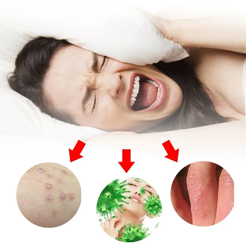 Psoriasis Creams Pain Relief Herbal Medical Plaster Eczema Ointment Skin Care Dermatitis Eczematoid itch
Psoriasis Creams Pain Relief Herbal Medical Plaster Eczema Ointment Skin Care Dermatitis Eczematoid itch