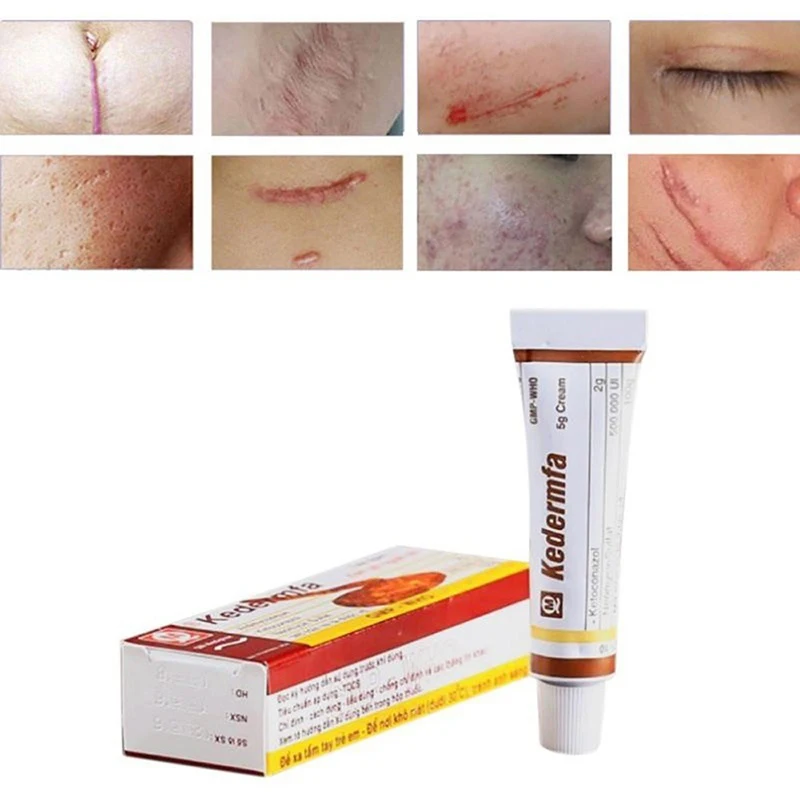 5g Vietnam Skin Cream Original Snake Oil Moisturizing Hand Cream Acne Scar Treatment Cream For Body Face Skin Repair Cream
5g Vietnam Skin Cream Original Snake Oil Moisturizing Hand Cream Acne Scar Treatment Cream For Body Face Skin Repair Cream