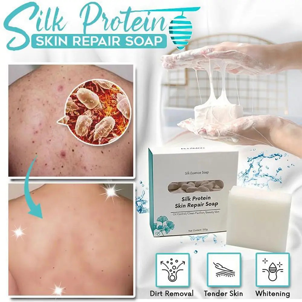 Moisturizing Repair Net Acne Super Long Brushed Cleansing Soap Silk Protein Skin Repair Soap Essence Soap Oil Control
Moisturizing Repair Net Acne Super Long Brushed Cleansing Soap Silk Protein Skin Repair Soap Essence Soap Oil Control