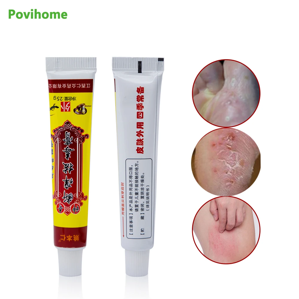 Psoriasis Eczema Antibacterial Ointment Feet Rotten Peeling Anti Itching Blisters Foot Cream Pain Relief Cream For Skin Problems
Psoriasis Eczema Antibacterial Ointment Feet Rotten Peeling Anti Itching Blisters Foot Cream Pain Relief Cream For Skin Problems