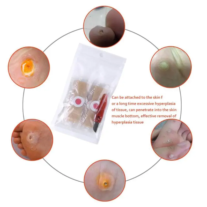 Foot Corn Detox Sticker Toe Calluses Thorn Patches with Corns Remover Kit Little Pain Effectively Remove Proliferative Tissue
Foot Corn Detox Sticker Toe Calluses Thorn Patches with Corns Remover Kit Little Pain Effectively Remove Proliferative Tissue