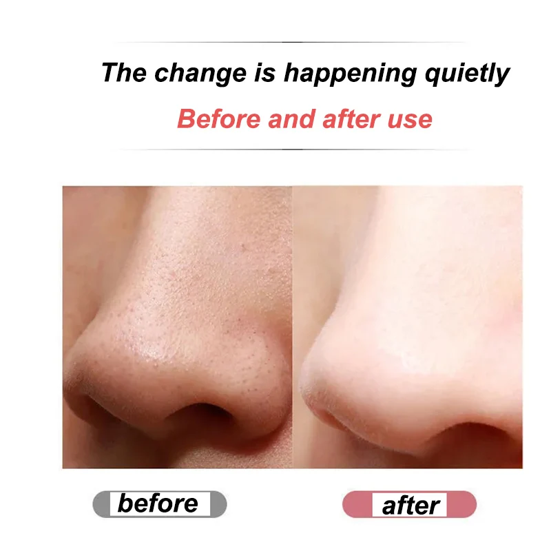 Facial ultrasonic vibration skin scrubber shove skin machine electric remove blackhead deep cleansing pore facial beauty device
Facial ultrasonic vibration skin scrubber shove skin machine electric remove blackhead deep cleansing pore facial beauty device