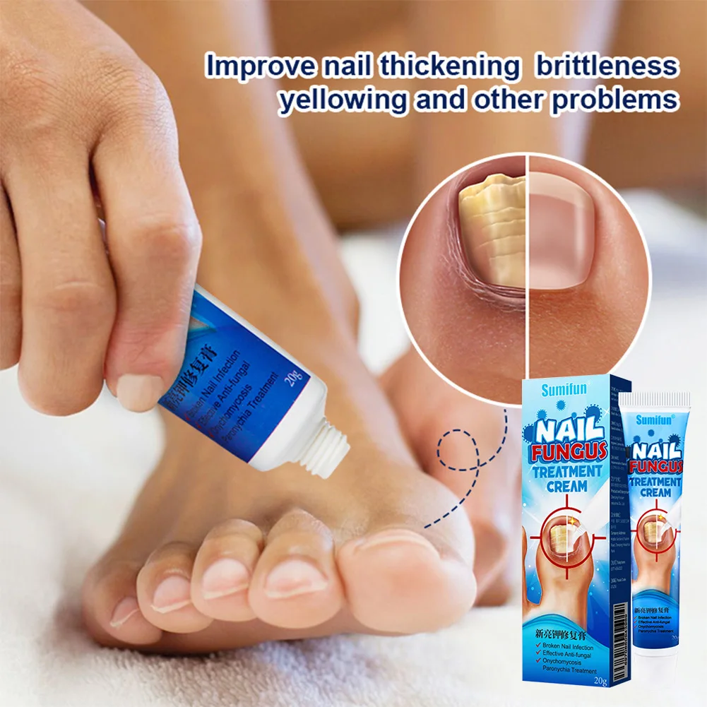 Nail Fungal Repair Cream Herbal Nail Treatment Cream Promote New Nails Growth Fingernails Toenails Care Cream Fast Delivery
Nail Fungal Repair Cream Herbal Nail Treatment Cream Promote New Nails Growth Fingernails Toenails Care Cream Fast Delivery