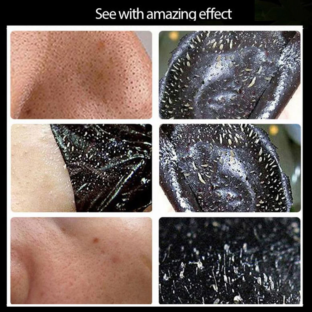 Blackhead Remover Mask Deep Pore Cleaning Peel-off Nose Mask for Removing Blackheads Acnes Skin Care Mask
Blackhead Remover Mask Deep Pore Cleaning Peel-off Nose Mask for Removing Blackheads Acnes Skin Care Mask