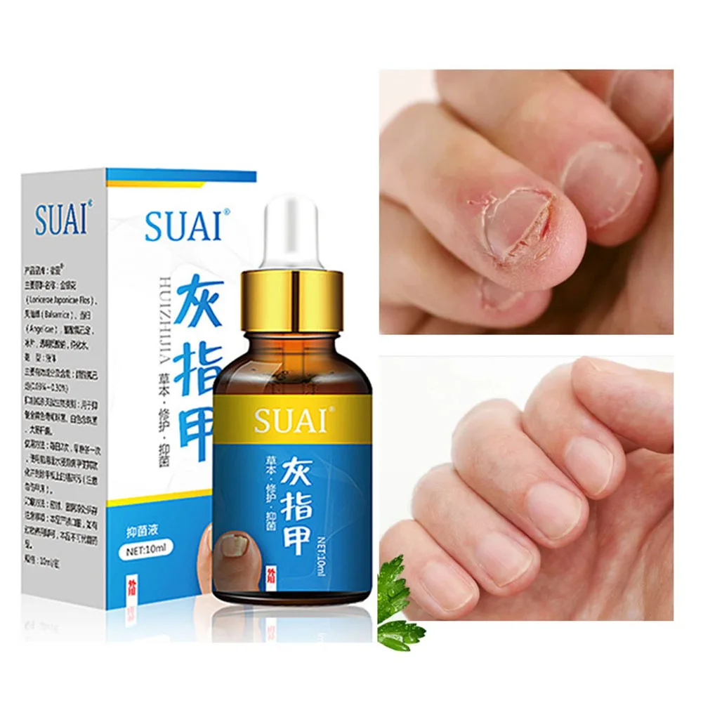 10ml Fungal Nail Repair Essence Serum Care Treatment Foot Nail Fungus Removal Gel Anti Infection Paronychia Onychomycosis Care
10ml Fungal Nail Repair Essence Serum Care Treatment Foot Nail Fungus Removal Gel Anti Infection Paronychia Onychomycosis Care