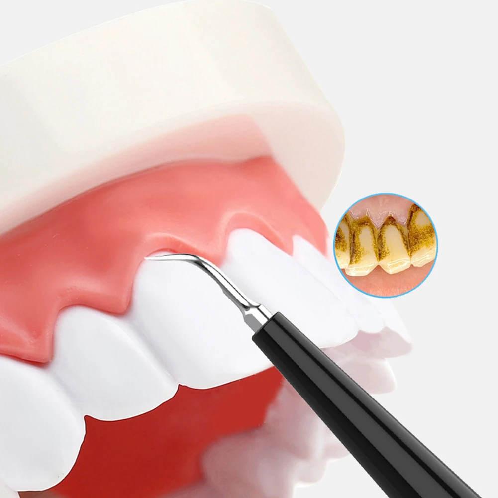 3 Modes Tooth Scaler Ultrasonic Vibration Electric Dental Scaler Tooth Tartar Plaque Stains Cleaner Teeth Whitening Tool
3 Modes Tooth Scaler Ultrasonic Vibration Electric Dental Scaler Tooth Tartar Plaque Stains Cleaner Teeth Whitening Tool