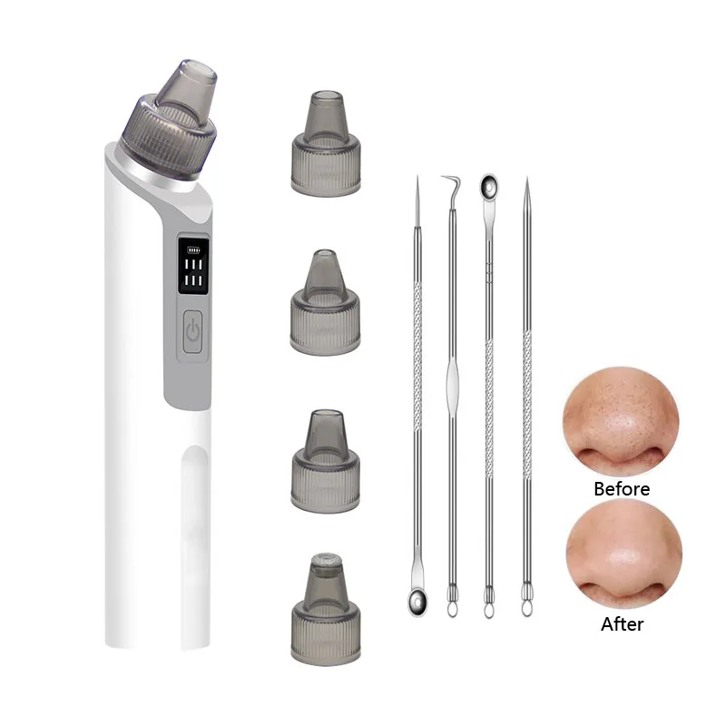 New Electric Blackhead & Blemish Removers 4 Heads One-click Start for Remove Acne and Blackhead Pore Extractor Facial Beauty
New Electric Blackhead & Blemish Removers 4 Heads One-click Start for Remove Acne and Blackhead Pore Extractor Facial Beauty