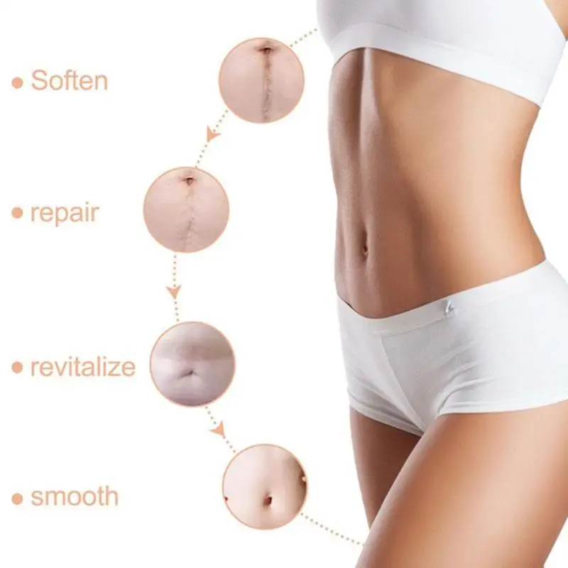 Remove Stretch Marks Beauty Patch Self Adhesive Reusable Gel Repair Silicone Stickers Skin Scar Acne K8I1
Remove Stretch Marks Beauty Patch Self Adhesive Reusable Gel Repair Silicone Stickers Skin Scar Acne K8I1