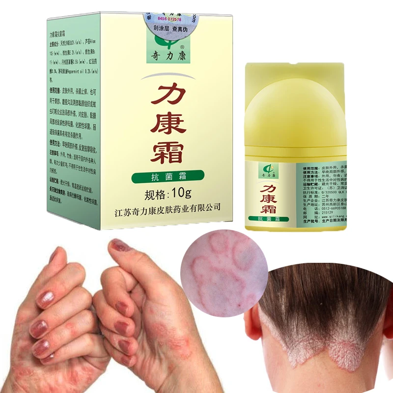 Anti Fungal Skin Cream Psoriasis Eczma Antibacterial Ointment Anti Itch Cream Antifungal Eczema Creams Chinese herbal Medicine
Anti Fungal Skin Cream Psoriasis Eczma Antibacterial Ointment Anti Itch Cream Antifungal Eczema Creams Chinese herbal Medicine