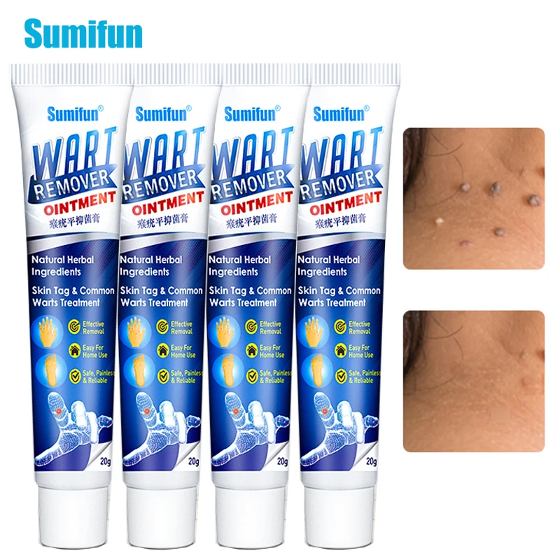 Sumifun 2/4Pcs Wart Ointment Removal Body Warts Treatment Skin Tag Remover Removal Genital Plantar Warts Cream Skin Care
Sumifun 2/4Pcs Wart Ointment Removal Body Warts Treatment Skin Tag Remover Removal Genital Plantar Warts Cream Skin Care