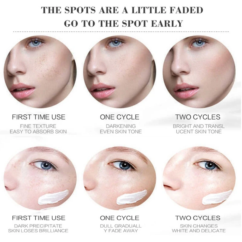 20g Remove Melasma Acne Spot Pigment Melanin Dark Spots Pigmentation Moisturizing Skin Gel Effective Whitening Freckle Cream
20g Remove Melasma Acne Spot Pigment Melanin Dark Spots Pigmentation Moisturizing Skin Gel Effective Whitening Freckle Cream