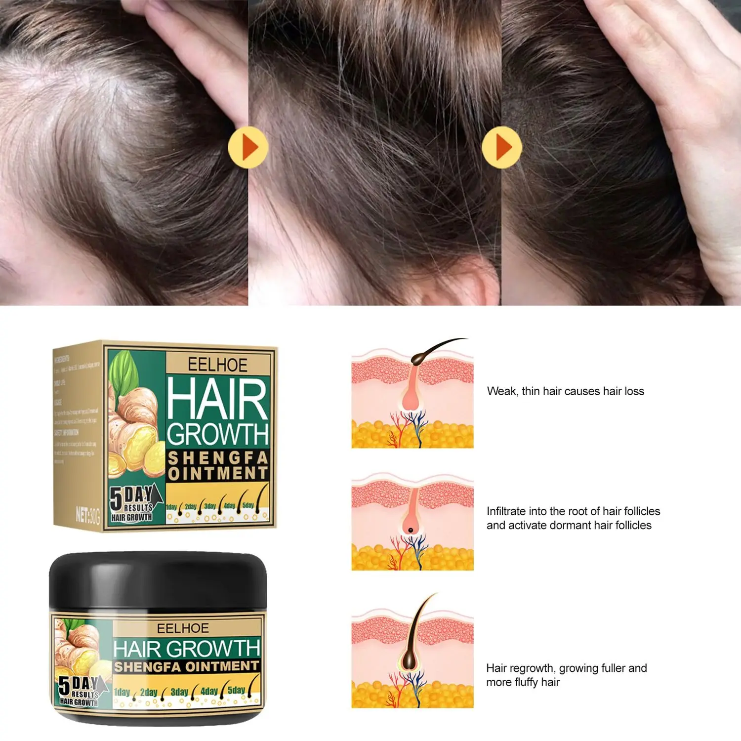 

Effective Pilatory Men Women Hair Care Ginger Oil Hair Loss Treatments Hair Growth Cream Repair Ointment