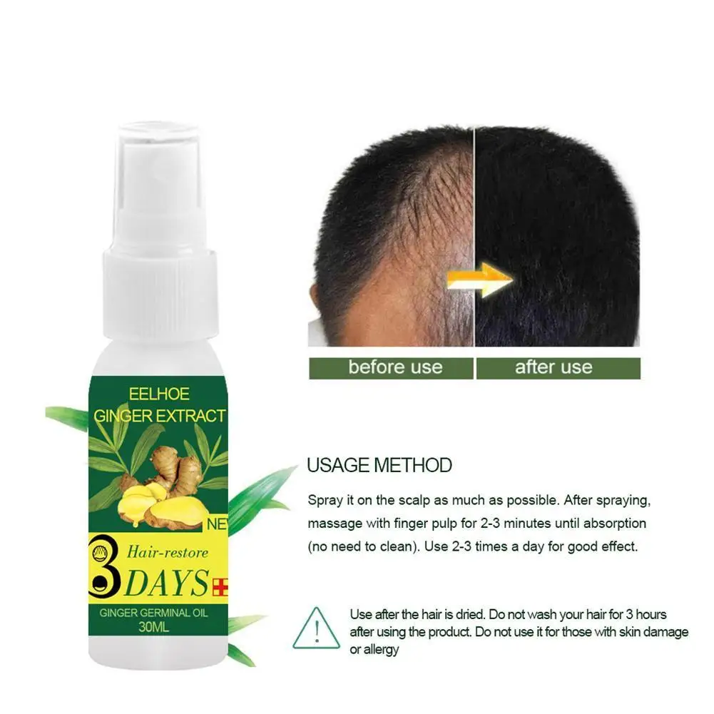 Ginger Essence Hair Oil Hairdressing Hairs Mask Hair Care Essential Essential Hairs Nutrition Hair Dry Oil Oil and Damaged N8B3
Ginger Essence Hair Oil Hairdressing Hairs Mask Hair Care Essential Essential Hairs Nutrition Hair Dry Oil Oil and Damaged N8B3