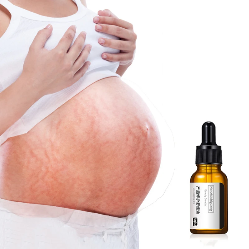 Anti Stretch Marks Massage Oil Stretch Marks Remover Essential Oil Skin Care Treatment Improves Skin Firmness A7
Anti Stretch Marks Massage Oil Stretch Marks Remover Essential Oil Skin Care Treatment Improves Skin Firmness A7