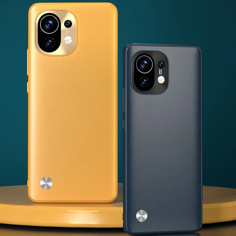 Роскошный тонкий защитный чехол из искусственной кожи для xiaomi mi 11 xiaomi11, креативный ударопрочный чехол
Роскошный тонкий защитный чехол из искусственной кожи для xiaomi mi 11 xiaomi11, креативный ударопрочный чехол