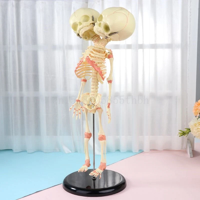 37cm Human Double Head Baby Skull Skeleton Anatomy Brain Display Study Teaching Anatomical Model
37cm Human Double Head Baby Skull Skeleton Anatomy Brain Display Study Teaching Anatomical Model
