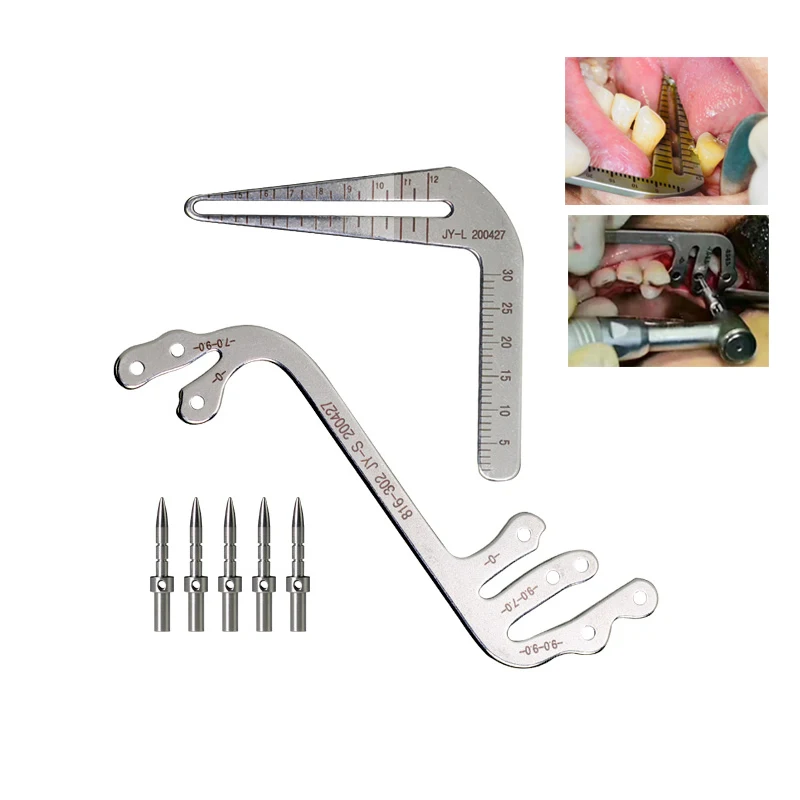 Dental Implant Surgery Instrument Oral Planting Locator Positioning Guide Drilling Positioning Ruler Angle Ruler Implant Tools
Dental Implant Surgery Instrument Oral Planting Locator Positioning Guide Drilling Positioning Ruler Angle Ruler Implant Tools