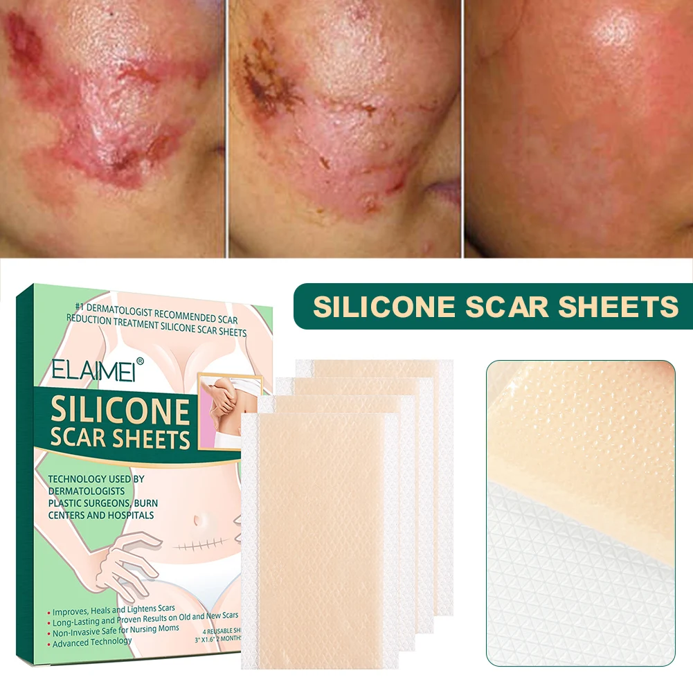 Silicone Surgical Scar Removal Patch Remove Trauma Burn Sheet Skin Repair Scar Removal Therapy Patch For Acne Scar Treatment
Silicone Surgical Scar Removal Patch Remove Trauma Burn Sheet Skin Repair Scar Removal Therapy Patch For Acne Scar Treatment