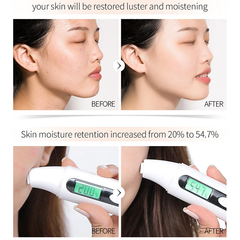 Face Serum skin whitening essence Vitamin C&E Anti-Aging Acne Shrink pores Hydration skin care
Face Serum skin whitening essence Vitamin C&E Anti-Aging Acne Shrink pores Hydration skin care